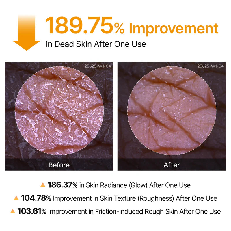 WomenWellnes Body Peel Spray - Kojic + Turmeric
