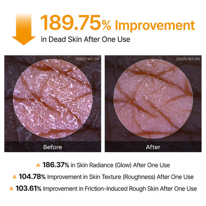 WomenWellnes Body Peel Spray - Kojic + Turmeric